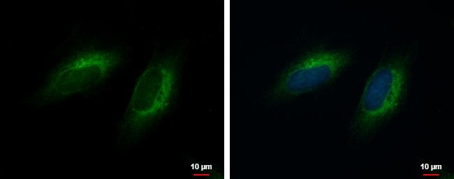 100uL Polyclonal antibody, COMMD10, host
