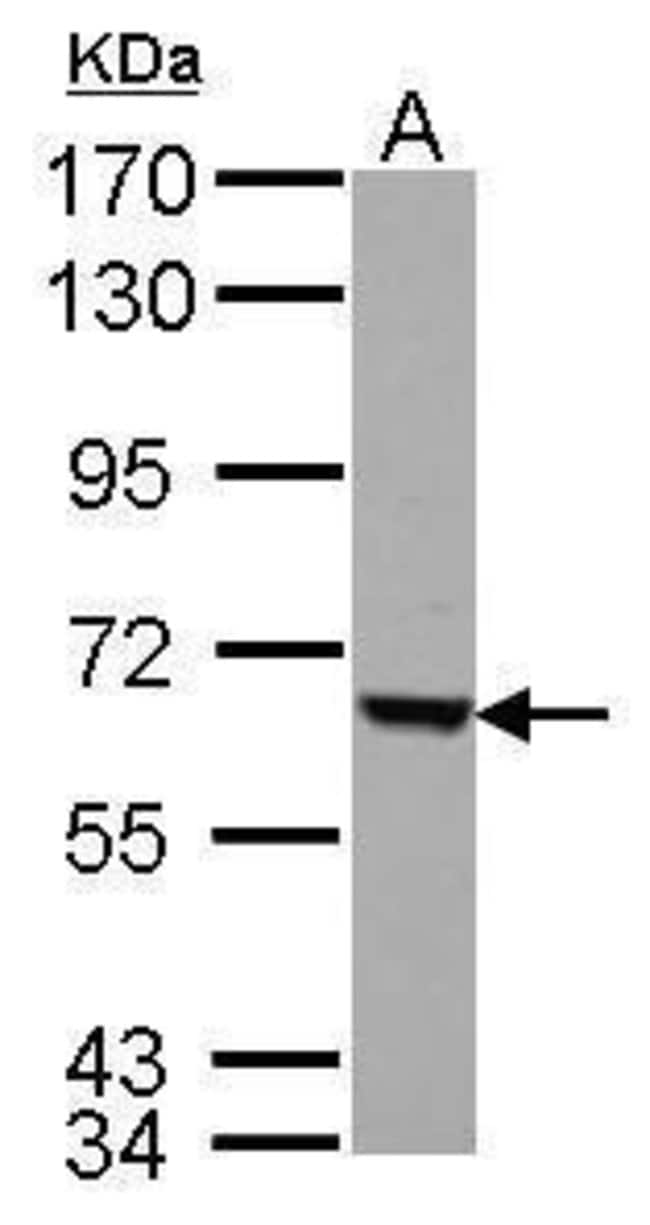 100uL Polyclonal antibody, FEM1C, host r