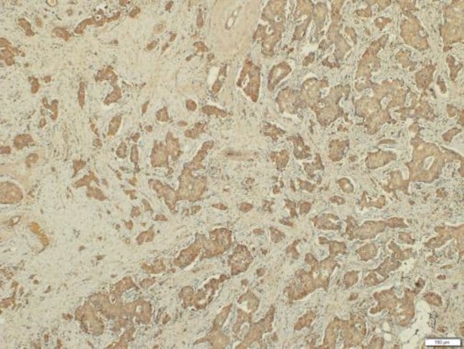 100uL Polyclonal antibody, RHAMM, host r