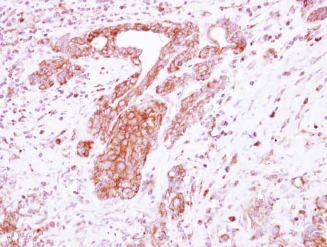 100uL Polyclonal antibody, netrin G1 lig