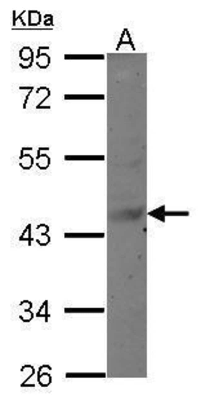 100uL Polyclonal antibody, MAGEB6, host