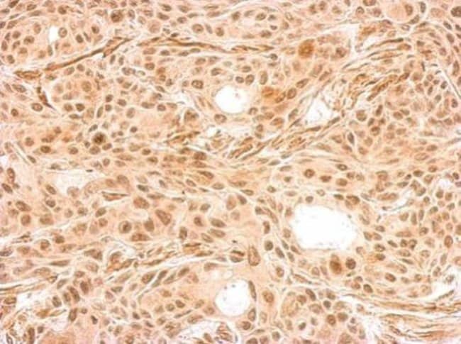 100uL Polyclonal antibody, HEXIM2, host