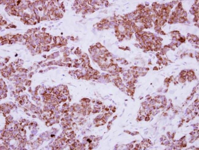 100uL Polyclonal antibody, LRRC23, host