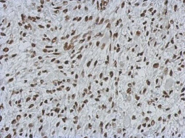 100uL Polyclonal antibody, MIER3, host r