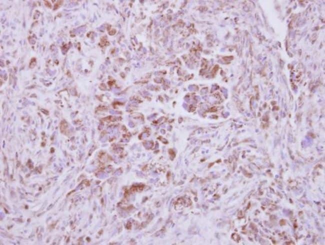 100uL Polyclonal antibody, NAPRT1, host