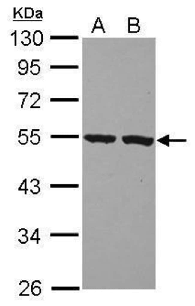 100uL Polyclonal antibody, PI16, host ra