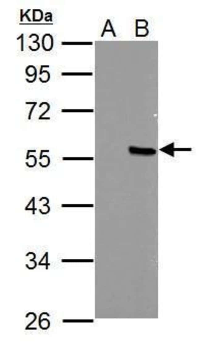 100uL Polyclonal antibody, PPP4R2, host