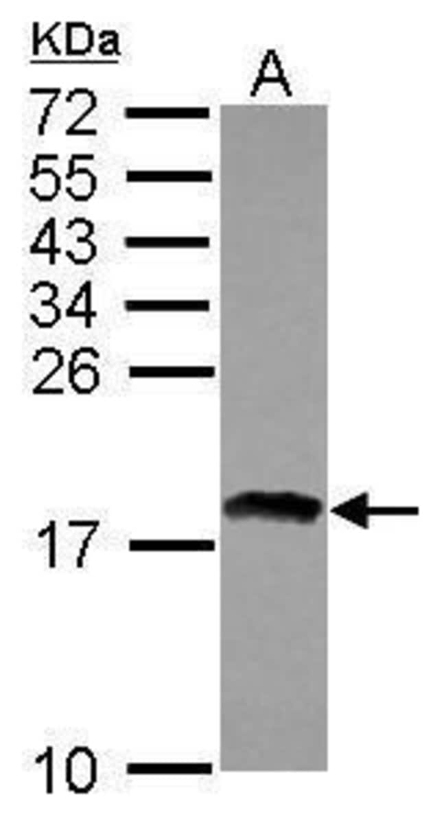 100uL Polyclonal antibody, RAX2, host ra