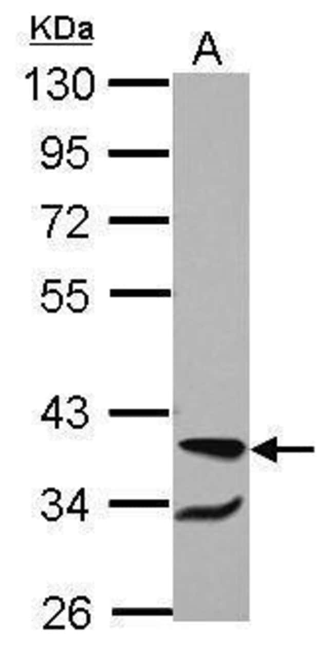 100uL Polyclonal antibody, RBM4, host ra