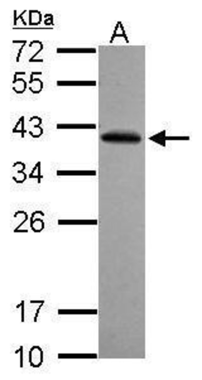 100uL Polyclonal antibody, RFPL2, host r