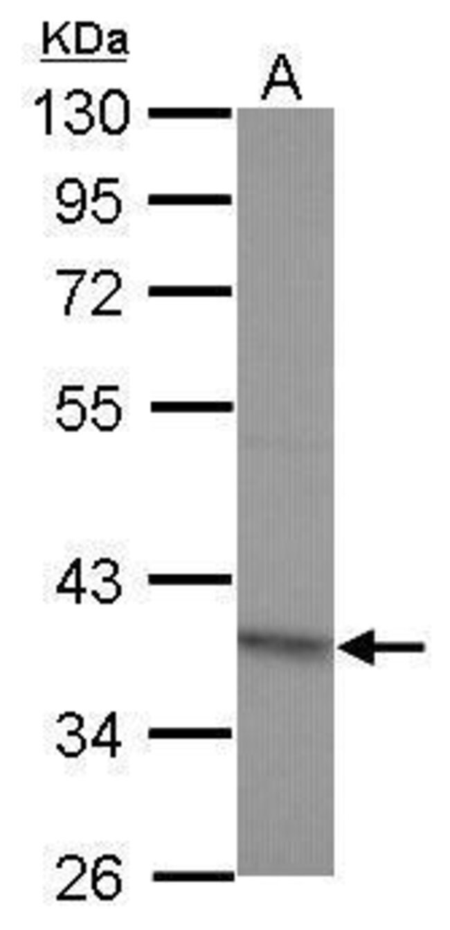 100uL Polyclonal antibody, RG9MTD2, host