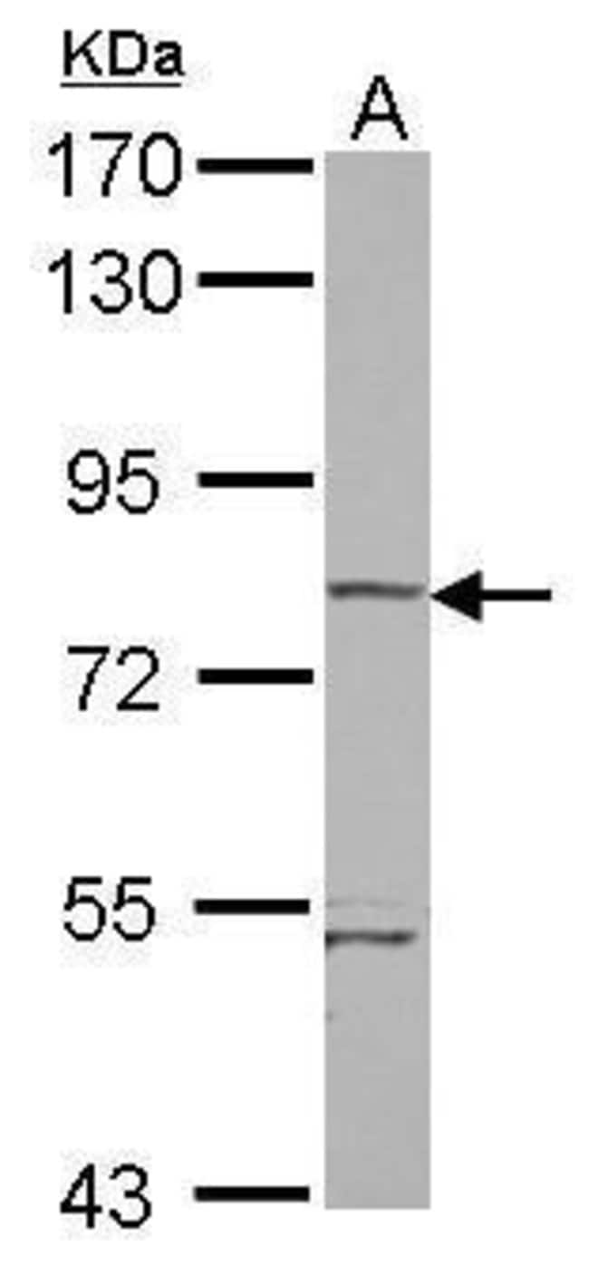 100uL Polyclonal antibody, RHOBTB1, host