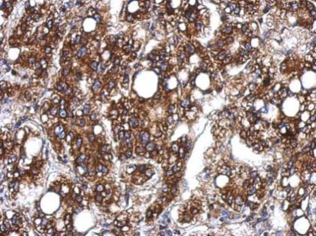 100uL Polyclonal antibody, Sts1, host ra