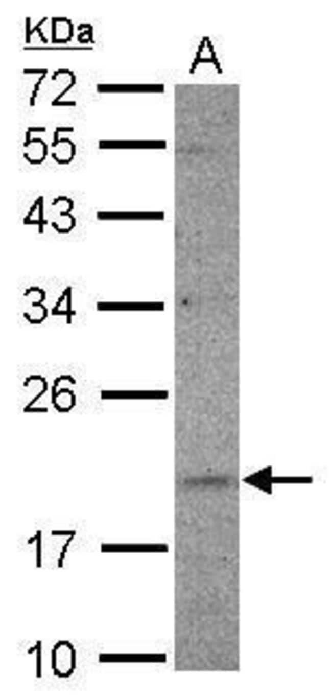 100uL Polyclonal antibody, UFC1, host ra