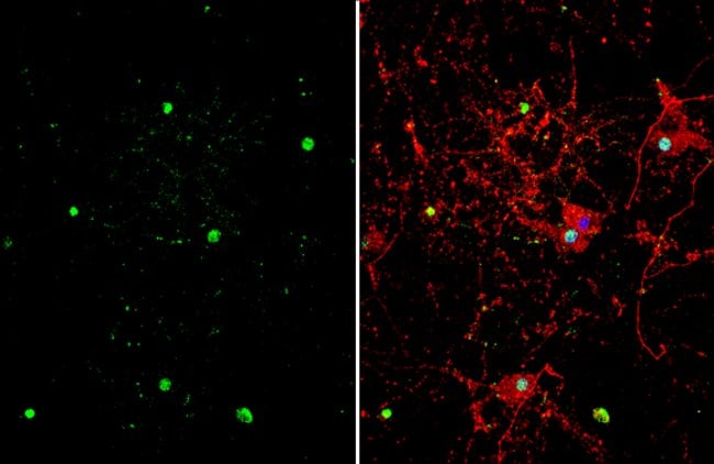 100uL Polyclonal antibody, ZBTB20, host