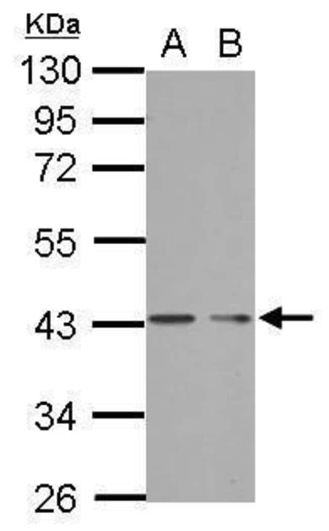 100uL Polyclonal antibody, PHF7, host ra
