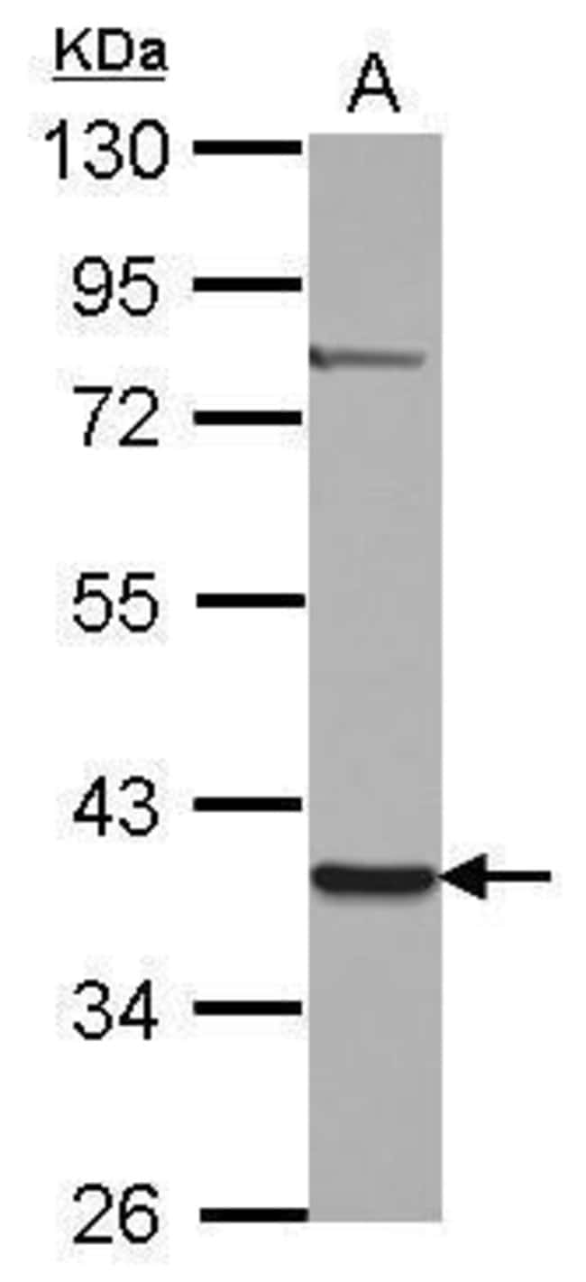 100uL Polyclonal antibody, ZNF302, host