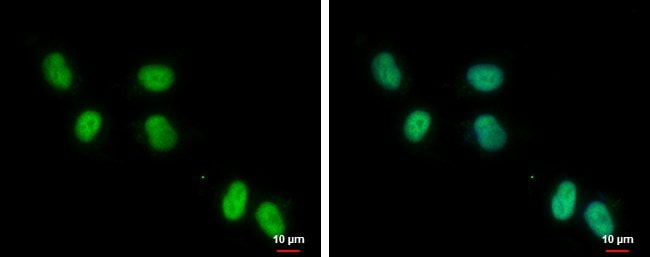100uL Polyclonal antibody, ZNF329, host
