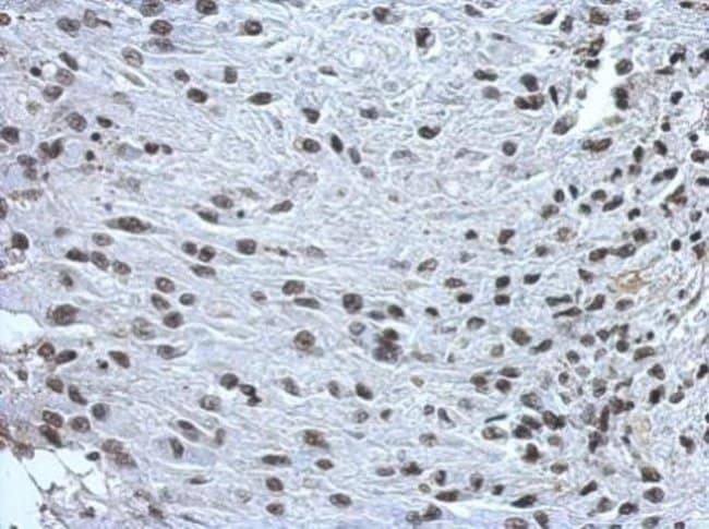 100uL Polyclonal antibody, ZNF649, host