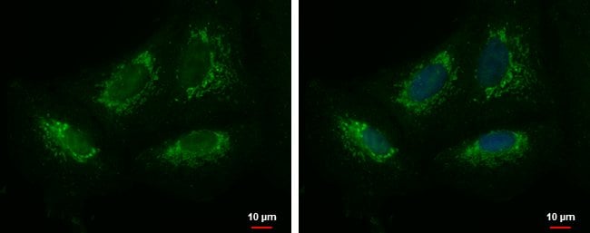 100uL Polyclonal antibody, KIAA0391, hos
