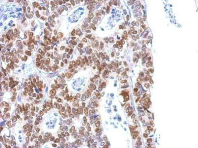 ANTI-PHOSPHO-HISTONE H1.4 PSER35