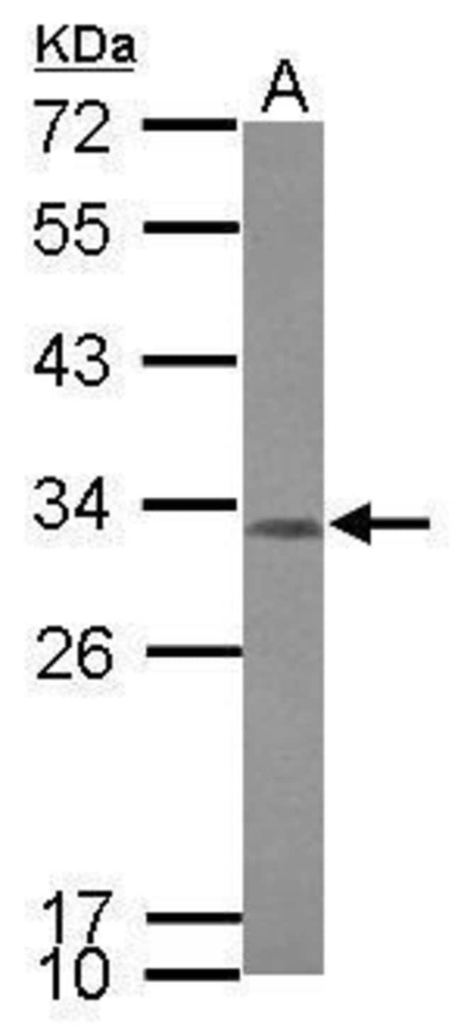 100uL Polyclonal antibody, CCDC44, host