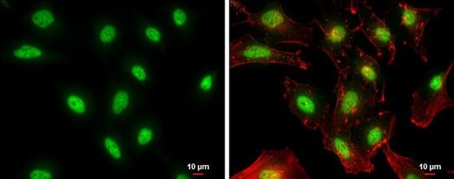 100uL Polyclonal antibody, NFYB, host ra