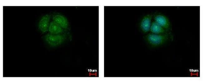 100uL Polyclonal antibody, AKT1+2+3, hos