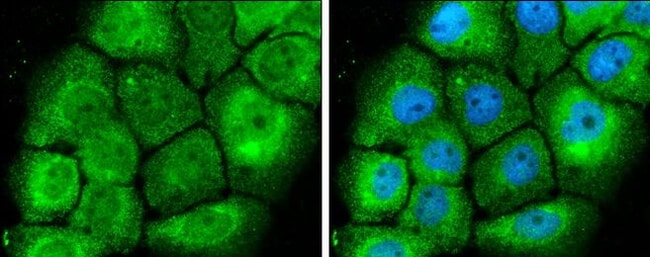100uL Polyclonal antibody, MEK1+2, host