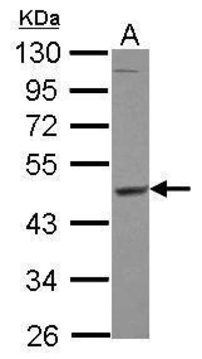 100uL Polyclonal antibody, MEK1+2, host