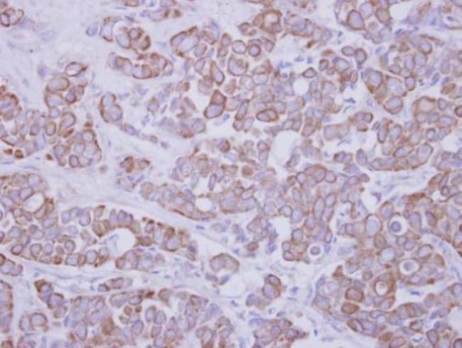 100uL Polyclonal antibody, GTDC1, host r