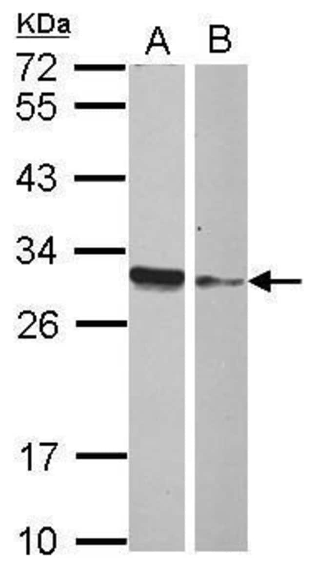 100uL Polyclonal antibody, HMGB4, host r