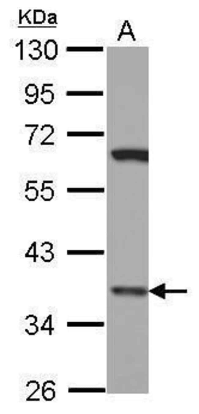 100uL Polyclonal antibody, LHX8, host ra