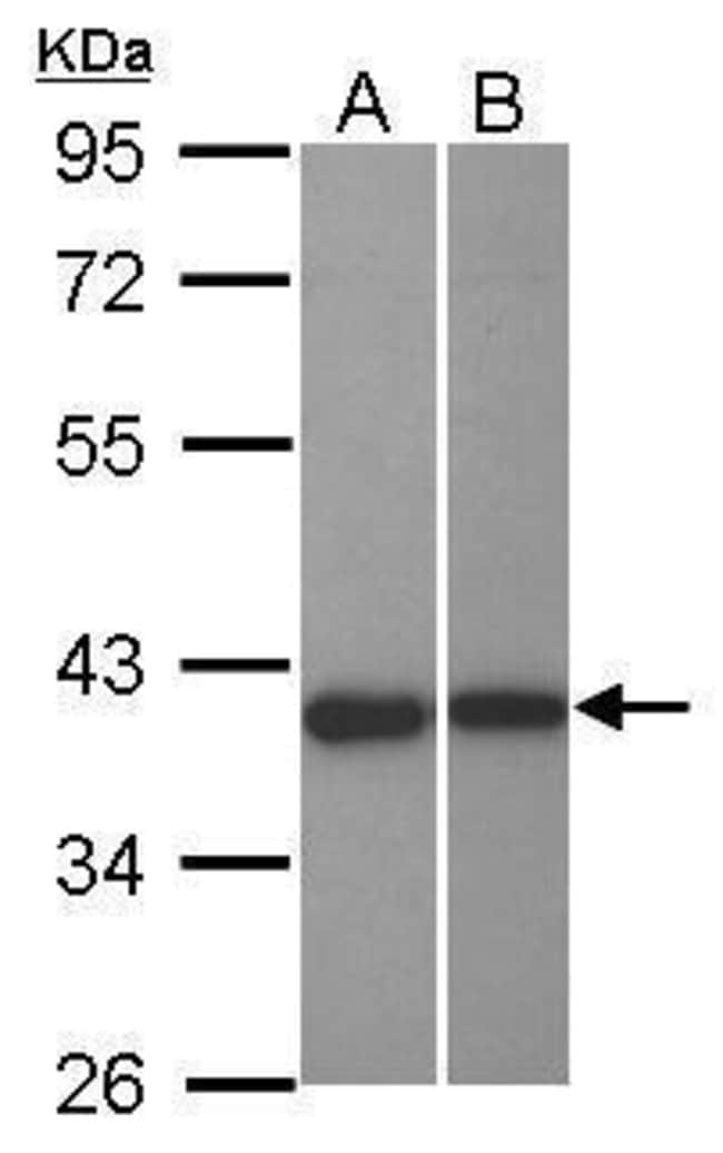 100uL Polyclonal antibody, LRRC23, host