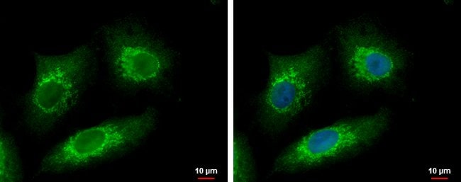 100uL Polyclonal antibody, metTL6, host