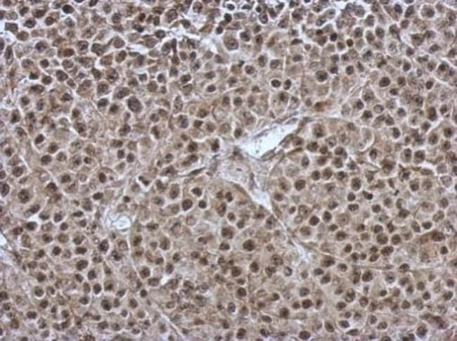 100uL Polyclonal antibody, OSBPL9, host