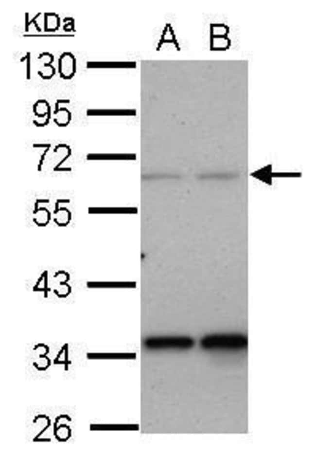 100uL Polyclonal antibody, PPP4R2, host