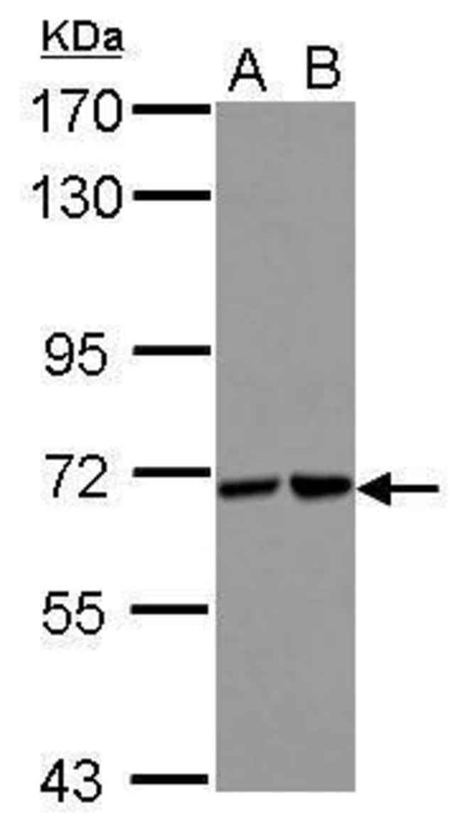 100uL Polyclonal antibody, Sts1, host ra