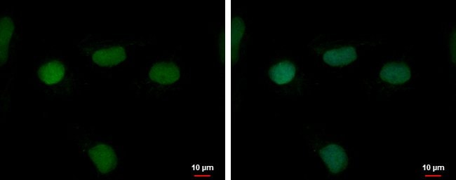 100uL Polyclonal antibody, RFPL4B, host