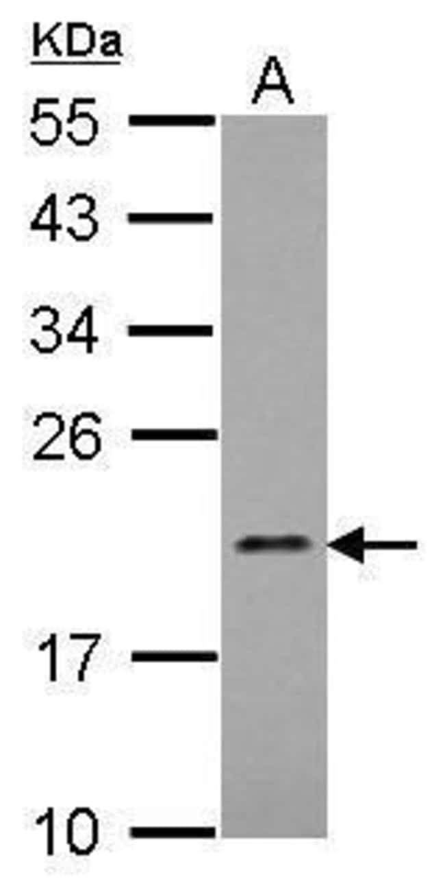 100uL Polyclonal antibody, MRPL21, host