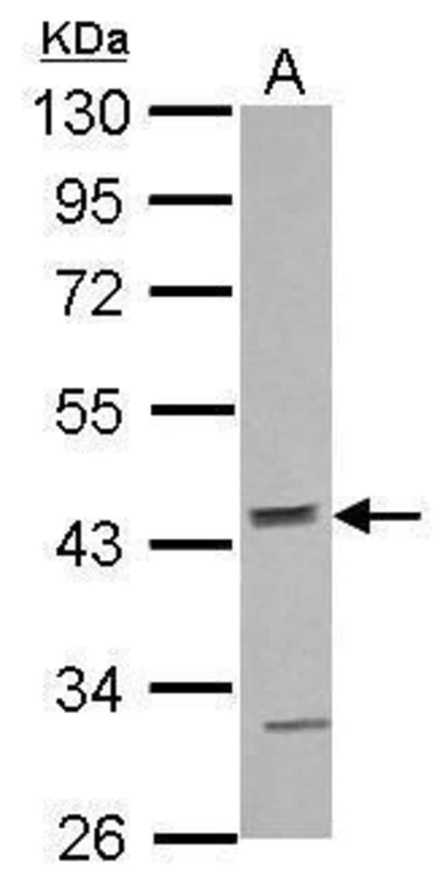 100uL Polyclonal antibody, ACTR10, host