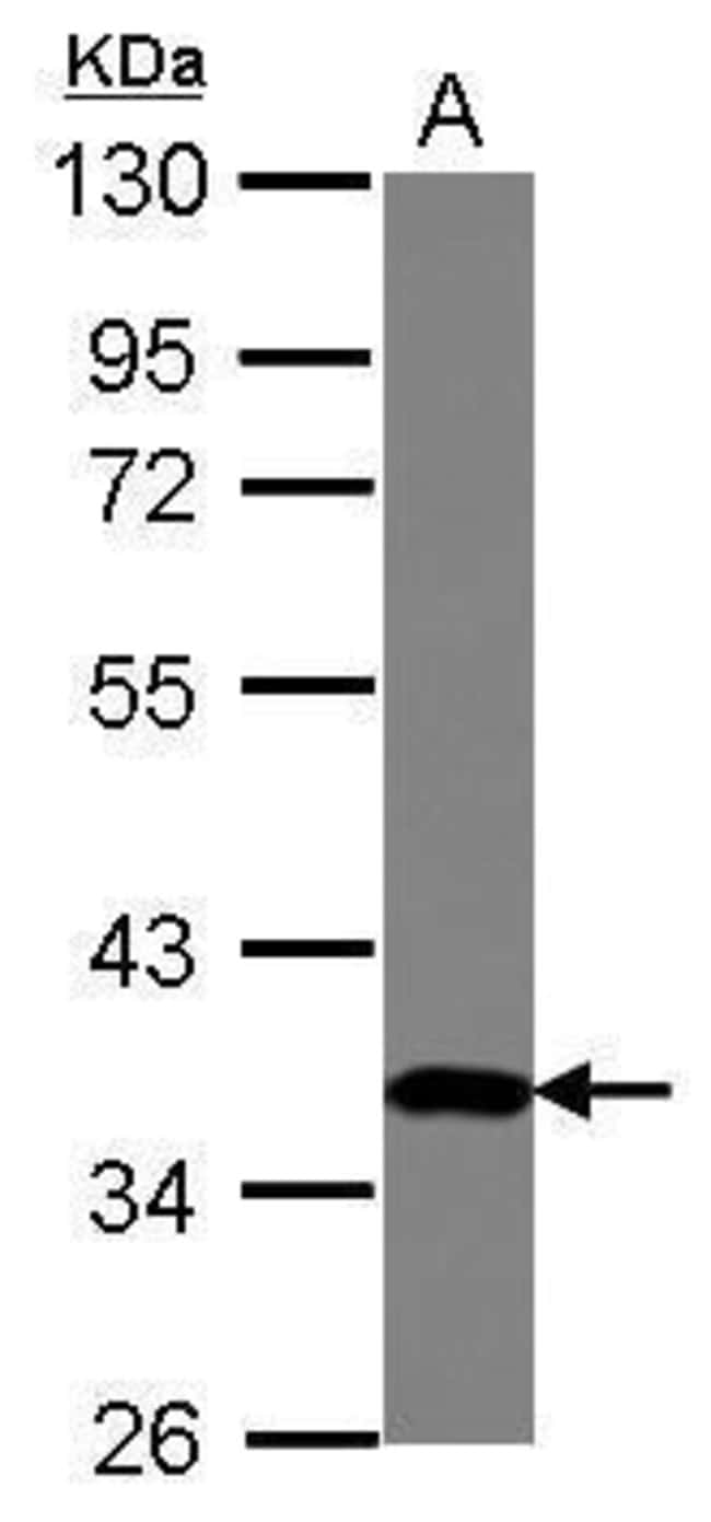 100uL Polyclonal antibody, ZNF177, host