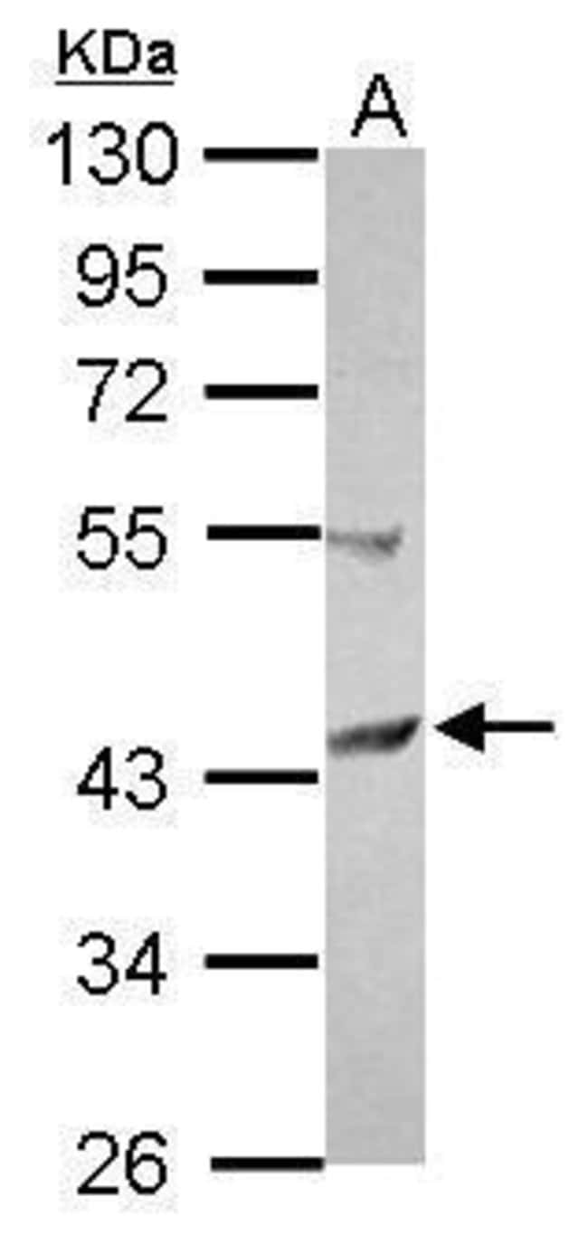 100uL Polyclonal antibody, SCCPDH, host
