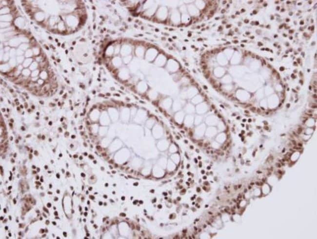 100uL Polyclonal antibody, R3HDM2, host