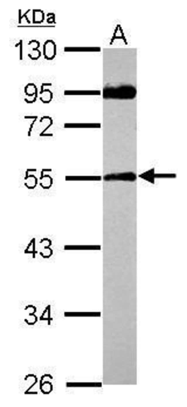 100uL Polyclonal antibody, SPAG8, host r