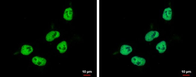 100uL Polyclonal antibody, ZNF329, host