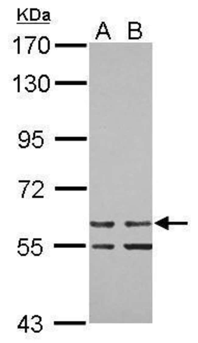 100uL Polyclonal antibody, ZNF419, host