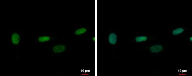 100uL Polyclonal antibody, ZNF419, host
