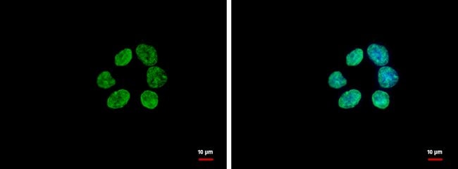 100uL Polyclonal antibody, histone H3, h