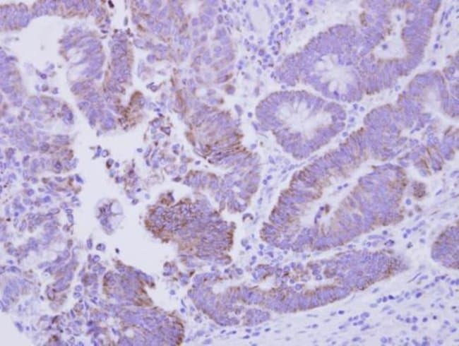 100uL Polyclonal antibody, CG1458, host